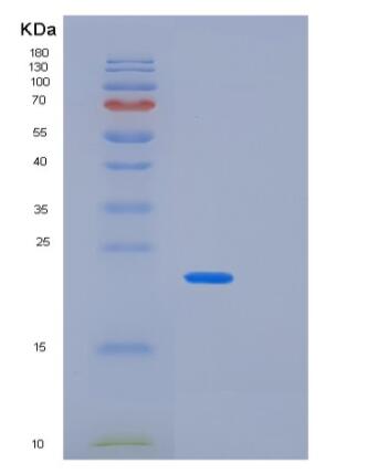 Recombinant Human PPP3R2 Protein