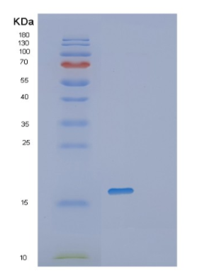 Recombinant Human PRND Protein