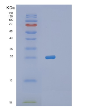 Recombinant Human PRNP Protein