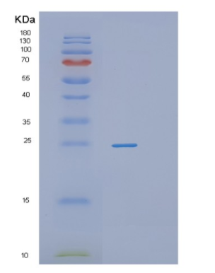 Recombinant Human PROCR Protein