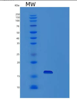 Recombinant Human Profilin-4 Protein