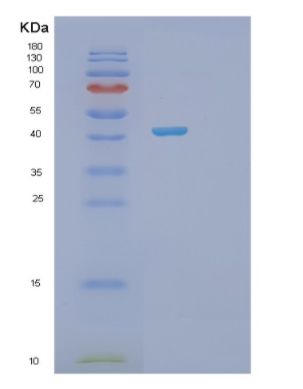 Recombinant Human PSAT1 Protein