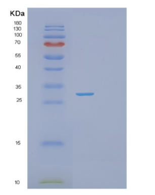 Recombinant Human PSEM3 Protein