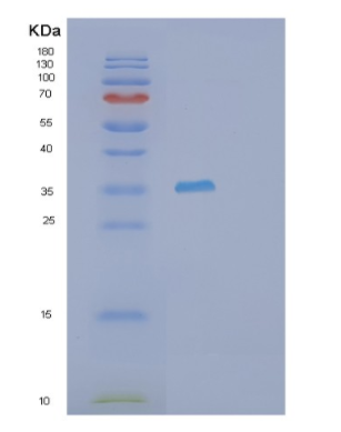 Recombinant Human PSG5 Protein