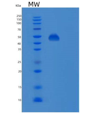 Recombinant Human PSMD11 Protein