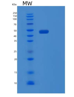 Recombinant Human PSTPIP1 Protein