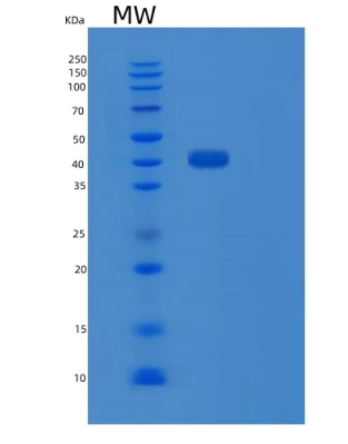 Recombinant Human PTPN7 Protein