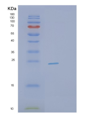 Recombinant Human PTTG1 Protein