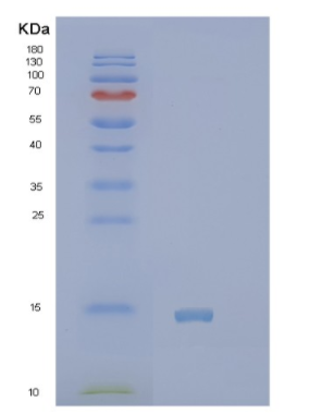 Recombinant Human PVALB Protein