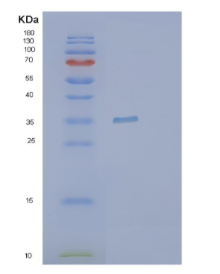 Recombinant Human PYCR1 Protein