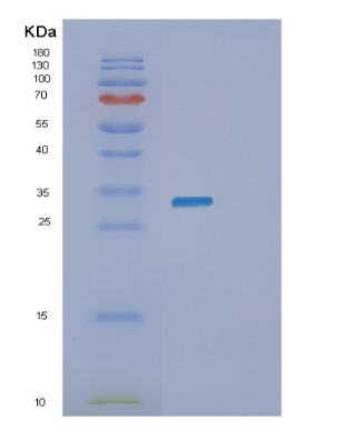 Recombinant Human PYCRL Protein