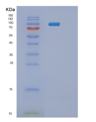 Recombinant Human PYGL Protein