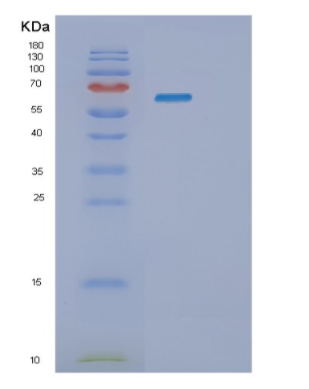 Recombinant Mouse Pyrethroid hydrolase Ces2e Protein