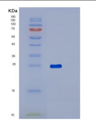 Recombinant Human RAB1B Protein