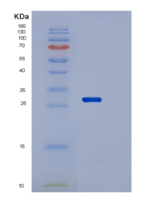 Recombinant Human RAB21 Protein