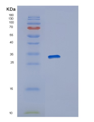 Recombinant Human RAB23 Protein