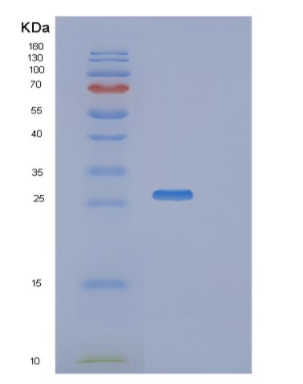 Recombinant Human RAB27B Protein