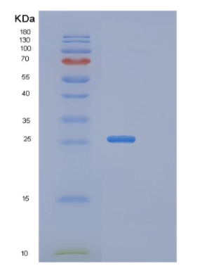 Recombinant Human RAB2A Protein