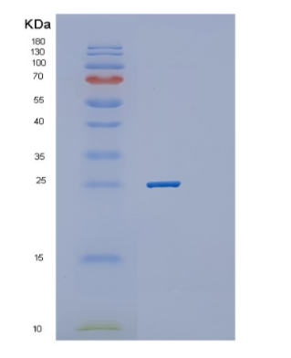 Recombinant Human RAB31 Protein