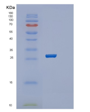 Recombinant Human RAB39B Protein