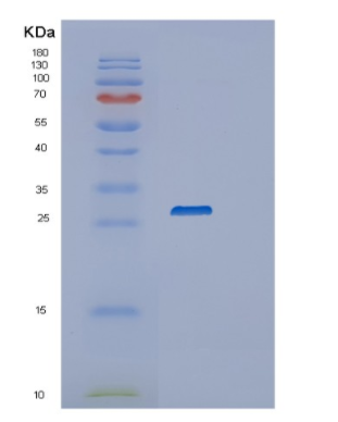 Recombinant Human RAB3A Protein