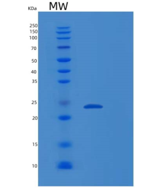 Recombinant Human RABL5 Protein