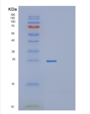 Recombinant Human RALA Protein