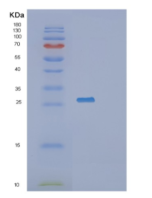 Recombinant Human RAN Protein