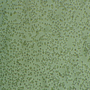 AR230-r人骨髓白血病细胞