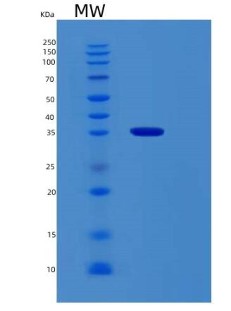 Recombinant Human RBM11 Protein