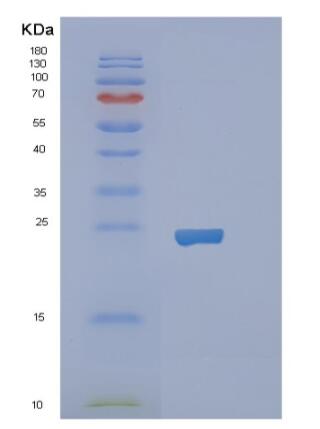 Recombinant Human RBP1 Protein