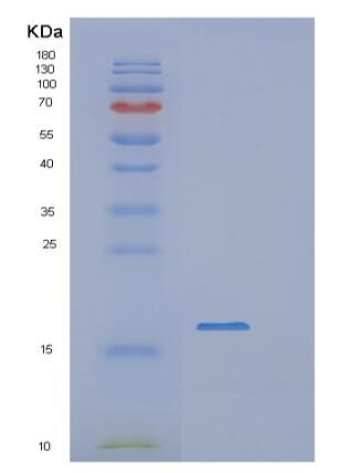 Recombinant Human RBP5 Protein