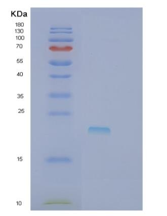 Recombinant Human RCAN3 Protein