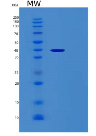 Recombinant Human RCN3 Protein