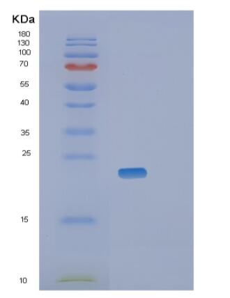 Recombinant Mouse Retinol-binding protein 4 Protein