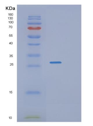 Recombinant Human RGS1 Protein