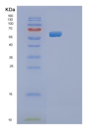 Recombinant Human RGS14 Protein