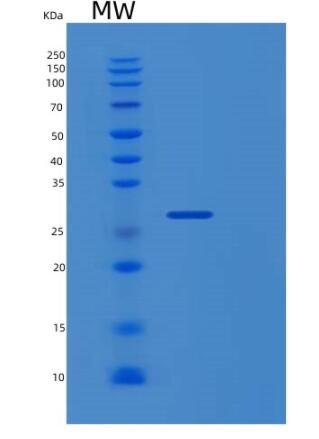 Recombinant Human RGS19 Protein