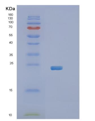 Recombinant Human RGS5 Protein