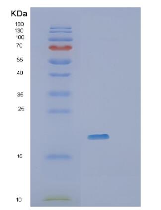 Recombinant Human RheB Protein