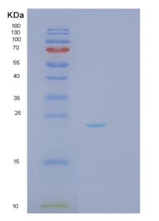 Recombinant Human RhoD Protein