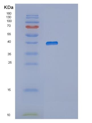 Recombinant Human RNLS Protein