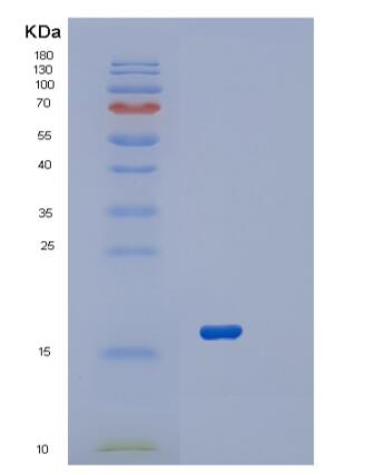 Recombinant Human RPL22 Protein