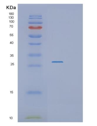 Recombinant Human RASSF3 Protein