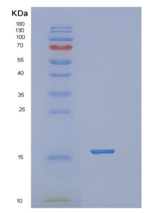 Recombinant Human RBP2 Protein