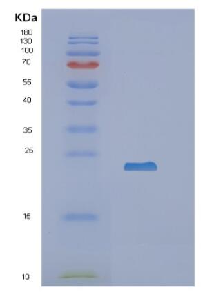 Recombinant Human RBP4 Protein