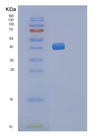 Recombinant Mouse Renin-1 Protein