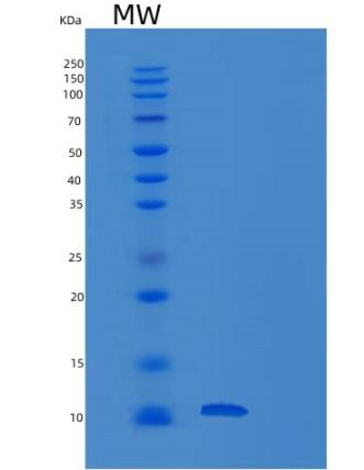 Recombinant Human RETN Protein