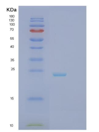 Recombinant Human RCAN2 Protein