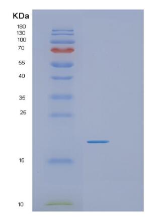 Recombinant Human RGS21 Protein